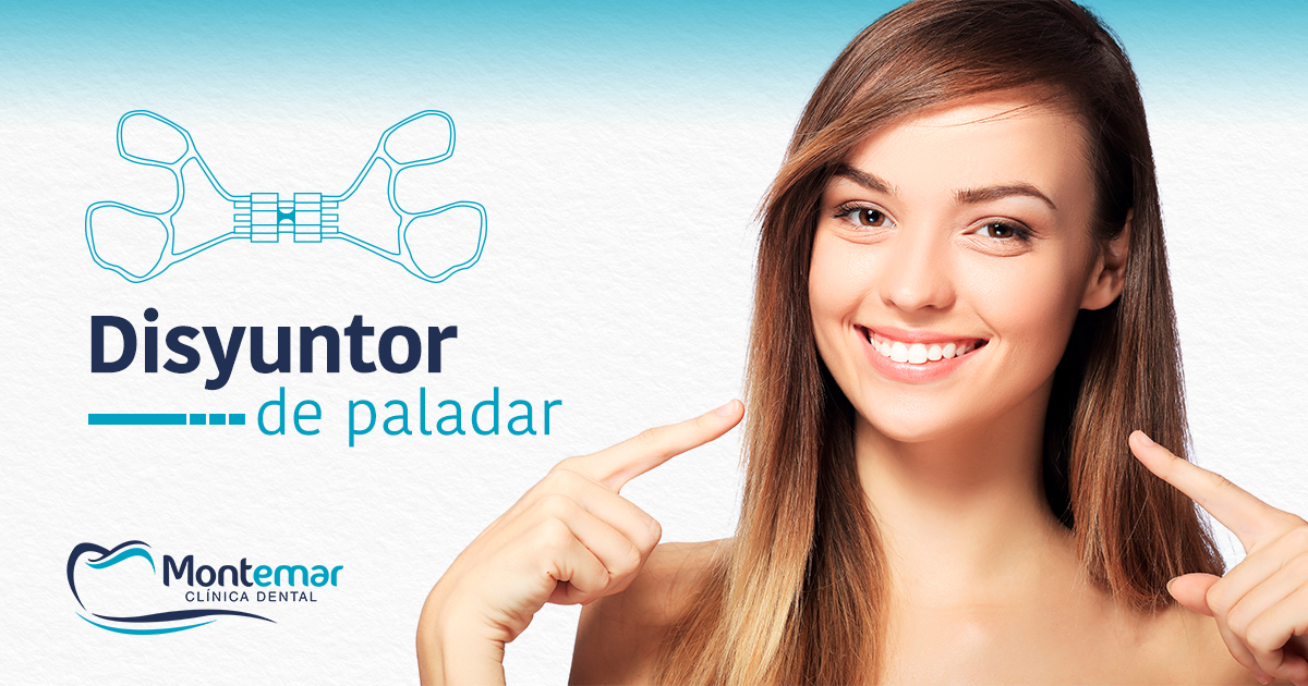 Disyuntor de paladar