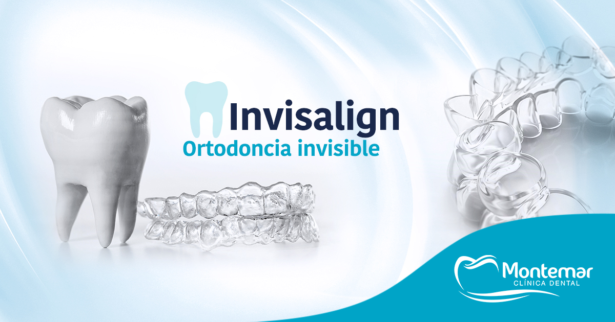 ¿Qué es la Ortodoncia Invisalign?