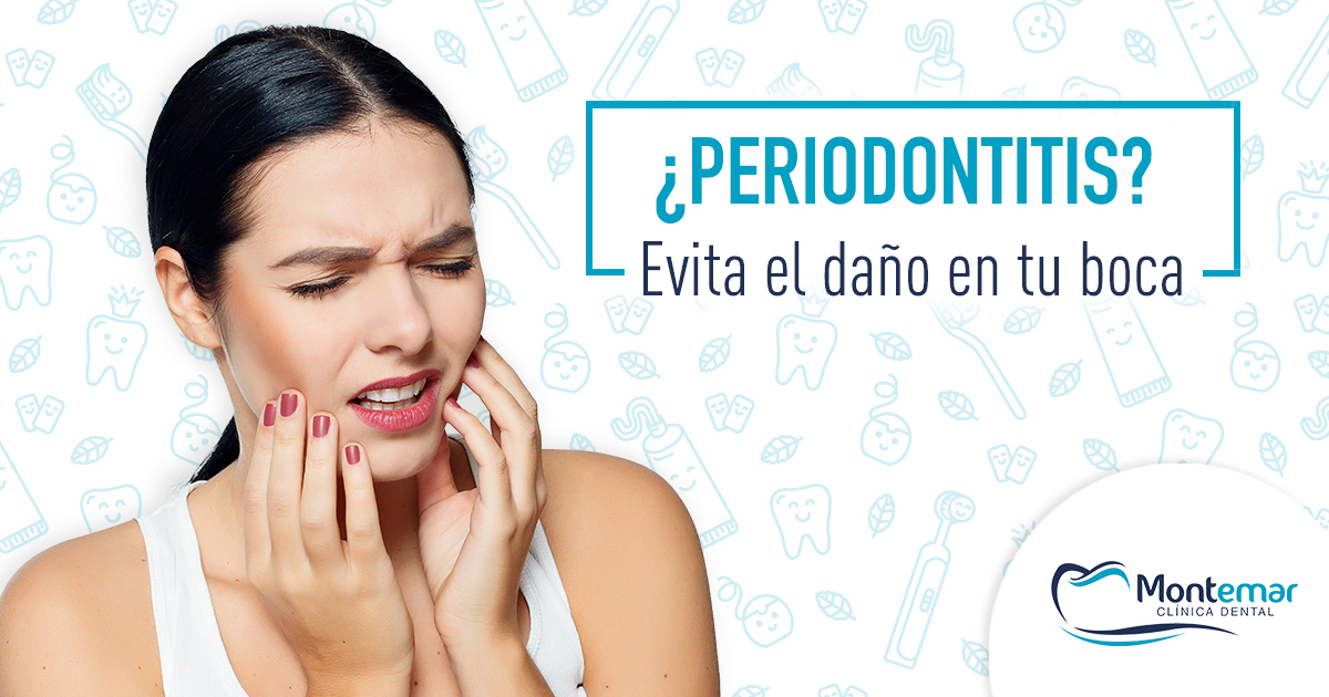 periodontitis