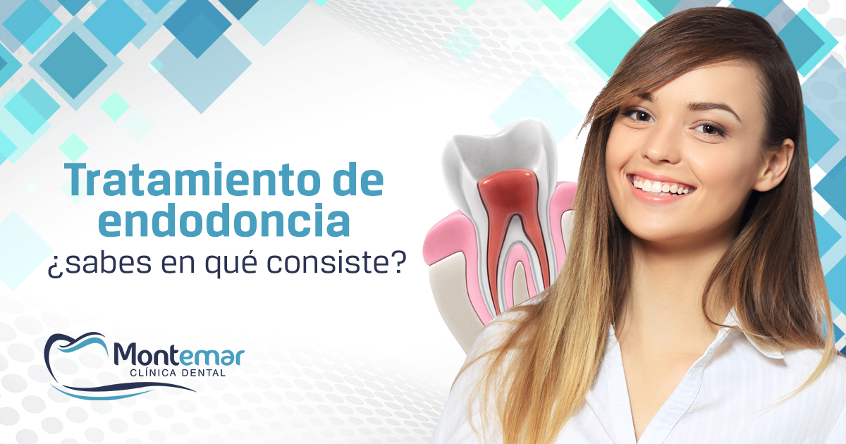 Tratamiento de endodoncia