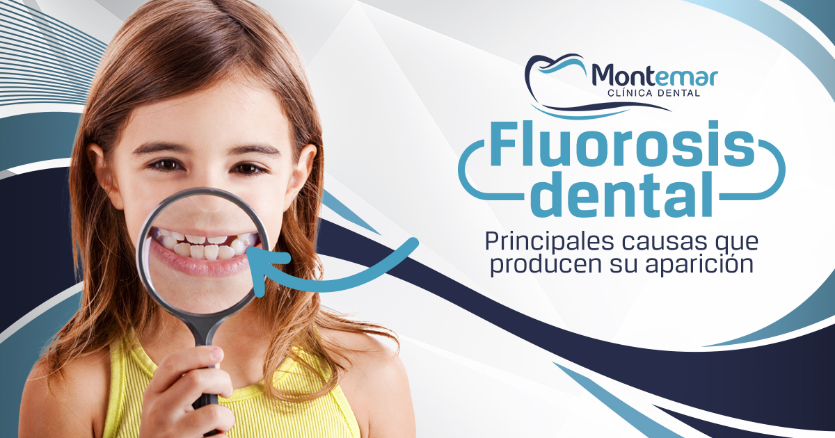 ¿Qué es la Fluorosis dental?