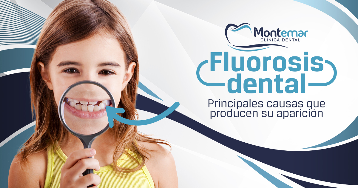 fluorosis