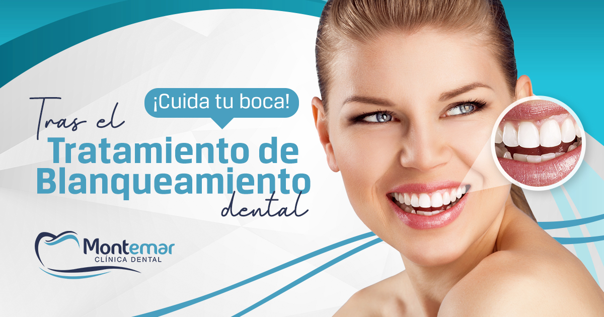 cuidados post blanqueamiento dental