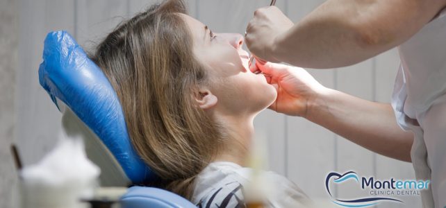 El tratamiento de Endodoncia, ¿en qué consiste?