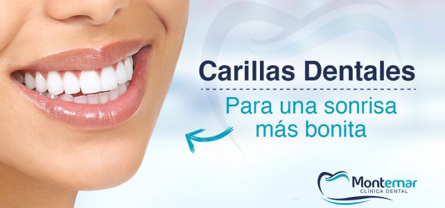 Carillas dentales. Elimine las imperfecciones de su sonrisa