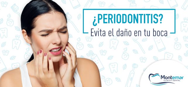 Periodontitis, no dejes que te quite la sonrisa