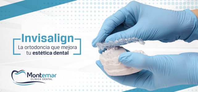 Invisalign: la ortodoncia estética sin brackets que mejora tu sonrisa