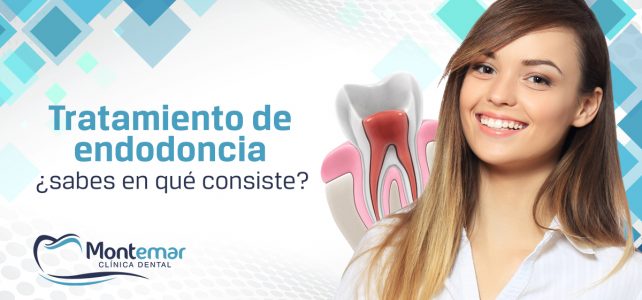 Tratamiento de endodoncia: mantén tu pieza dental a salvo