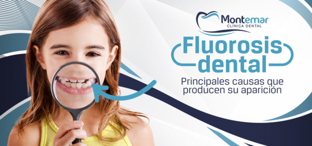 Fluorosis dental: la cara B del exceso de flúor sobre tus dientes