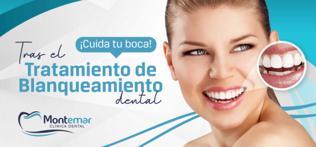 Cuidados post blanqueamiento dental. ¡No dejes de sonreír! 