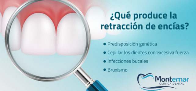 Retracción de encías, qué es y cómo solucionarla